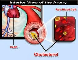 obat herbal kolesterol tinggi